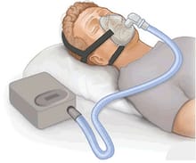 Philips DreamStation Auto CPAP
